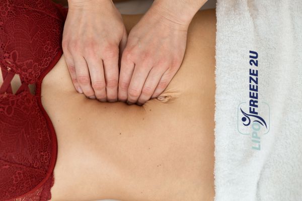 diastasis recti treatment Bletchley