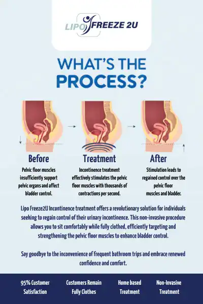 Diagram of how incontinence treatment Bletchley works.