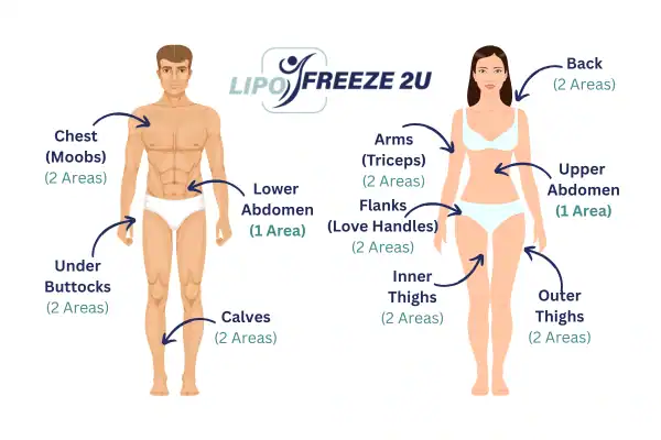 Areas you can have fat freezing treatment Bletchley