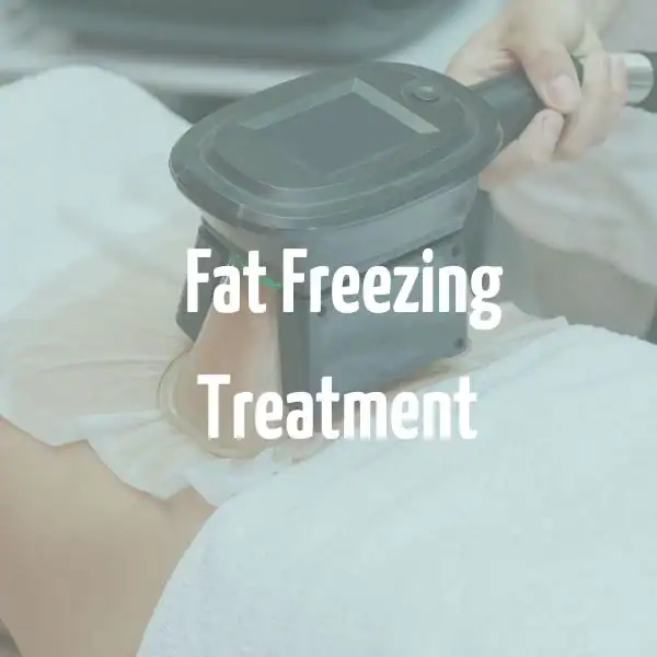 fat freezing treatment Bletchley