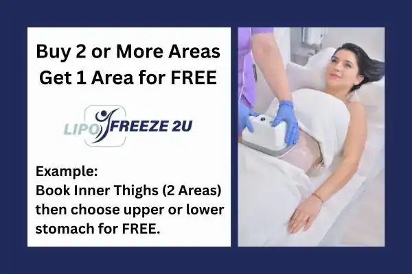 fat freezing prices Bletchley
