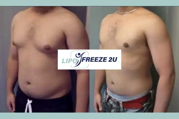 How Long Does It Take to See Results Bletchley?