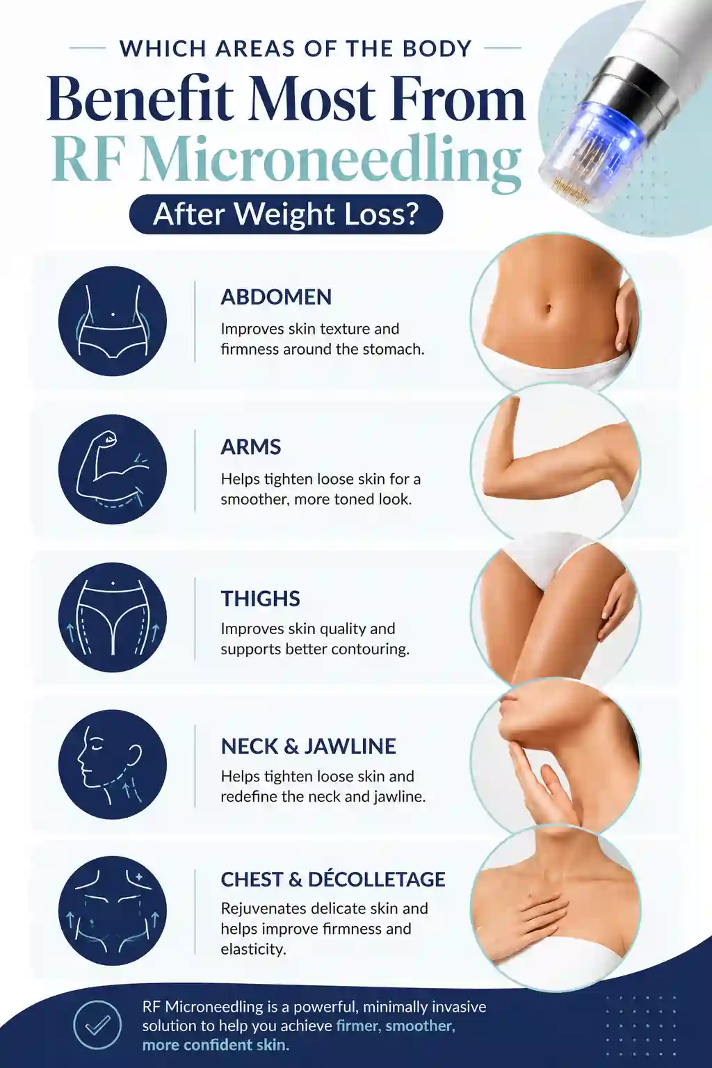 Which Areas of the Body Benefit Most From RF Microneedling After Weight Loss Bletchley